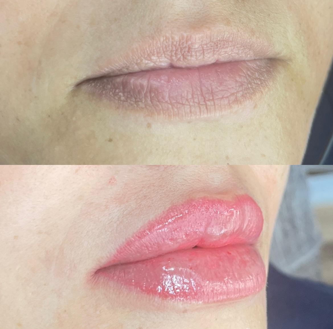 NEUTRALIZACIÓN DE LABIOS 💄